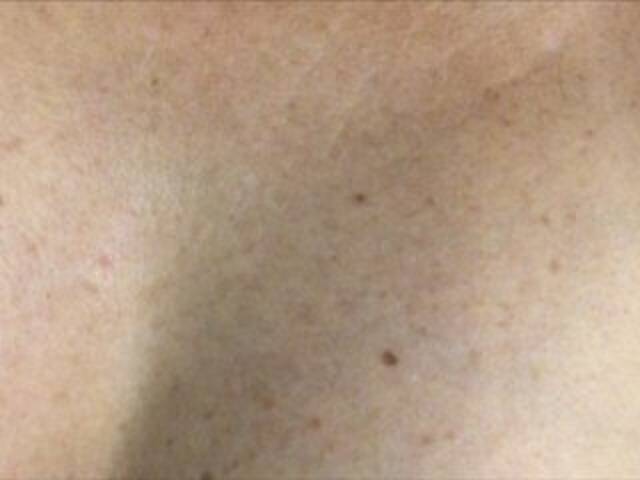 Capturas de tela de transmissão Alianakiss